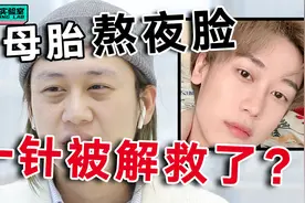 熬夜党集合！20年的重度黑眼圈，其实一招就能解决！视频封面