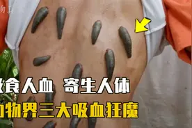 钻入人体吸食血液，一旦被咬全身瘙痒难耐，盘点动物界三大吸血鬼视频封面