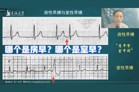 通过一幅心电图，专家教你怎么区分房性早搏和室性早搏？视频封面
