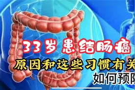 33岁结肠癌，与这些不当饮食因素有关，医生教你如何预防视频封面