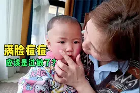 小宝无缘无故满脸红痘痘，整个脸看起来都发肿，季节性过敏要注意视频封面