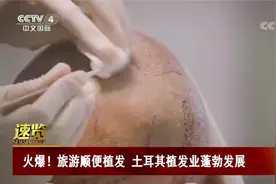 旅个游头发就“长”出来了！这个国家的植发旅游大热视频封面
