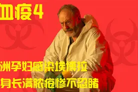 血疫4：非洲孕妇感染埃博拉，浑身长满脓疮，家中老小无一幸免视频封面