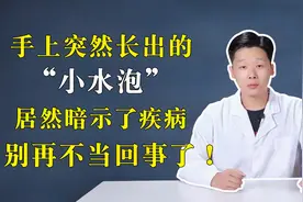手上突然长出的“小水泡”居然暗示了疾病，别再不当回事了！视频封面