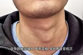 男人50岁以后，雄激素依然旺盛一定是好事？或招来2个问题 (1)视频封面