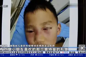 湖南长沙一5岁男孩因挖鼻孔脸肿似“奥特曼”，医生这样说视频封面