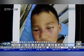 湖南长沙一5岁男孩因挖鼻孔脸肿似“奥特曼”，医生这样说视频封面
