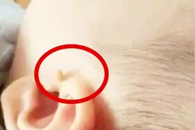 老人常说说耳朵长“拴马桩”是天生的富贵相，是真的吗？视频封面