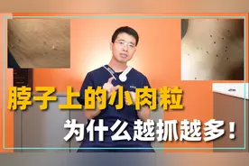 脖子上的小揪揪越抓越多？有可能是感染病毒！医生教你如何解决视频封面