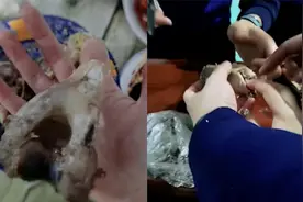 女子吃大棒骨美甲被卡，打车到消防队求助取出来，结局惹爆笑！视频封面