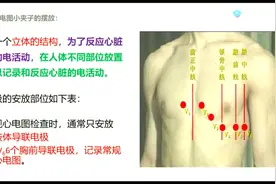 某三甲医院医生竟这样教你胸前导联的摆放位置，听完获益匪浅！视频封面
