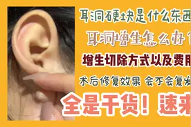 【大朦】耳洞长了硬块！增生治疗切除的方式及费用！超全干货速来视频封面