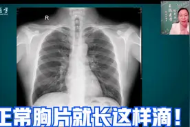 一副正常胸片可以看出哪些内容？专家带你深度解剖正常胸片！视频封面