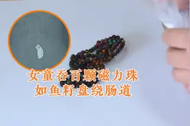 女童误吞上百颗磁力珠 肠道内如鱼籽盘绕 医院紧急手术视频封面