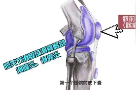 临床实用解剖系列--膝关节滑膜囊，滑膜炎、滑囊炎诊治相关解剖视频封面