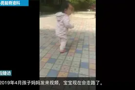 婴儿脑积水头部慢慢变大，李小勇脑脊液科治后身体智力发育均正常视频封面