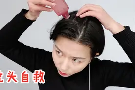 脱发指南：秃顶和发际线上移是两回事？3款防脱发精华液大吐槽视频封面
