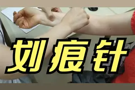 头皮又疼又痒，医生使出“划痕针”，病症一目了然视频封面