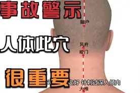 实例 精神疾病女子因针灸事故而死亡视频封面