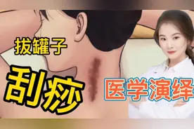 医学演绎 人体为什么要拔罐子还要刮痧 到底有什么好处和坏处？视频封面