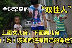 全球罕见的双性人，上半身女性下半身男性，该怎样选择命运呢