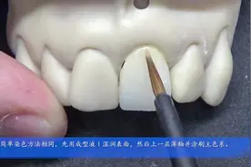 牙齿上釉就能达到上瓷的效果，想学Biomic糊剂一次外染方法吗视频封面
