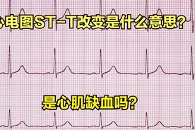 心电图的ST-T改变是心肌缺血吗？需要治疗吗？视频封面