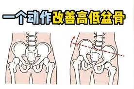 什么原因会引起高低骨盆呢？视频封面