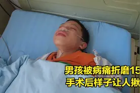 男孩双腿畸形，被病痛折磨15年，手术后样子让人揪心视频封面