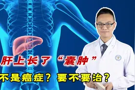 B超显示肝上长了“囊肿”，是不是癌症的前兆？要不要治？视频封面