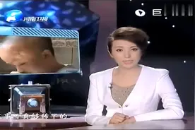 山区男孩长相怪异，头部发育异于常人，被村民称为“怪物”！视频封面