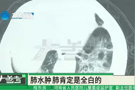 多名孩子感染甲流后“白肺”，医生提醒：感觉不适要及时就医视频封面