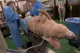 日本人要把猪的器官移植到人身上，如果是你，你能接受吗视频封面