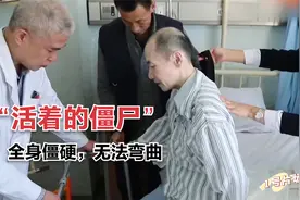 男人患上罕见疾病，被称为“活着的僵尸”，全身硬邦邦无法弯曲视频封面