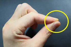 502胶水粘手分不开，教你一新招，胶水很快就溶解，方法简单实用视频封面