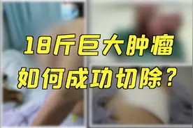 18斤罕见特大肿瘤，多学科专家花了八小时成功切除！视频封面