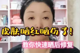 皮肤晒红晒伤了不用怕，教你省钱快速晒后修复，退红镇静预防晒斑视频封面