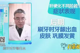 经常牙龈出血莫轻视，当心肝硬化找上门，来看这个案例|生活圈视频封面