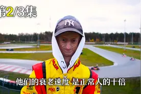 18岁的少年，看起来像80岁老头，这都是早衰症惹的祸！视频封面
