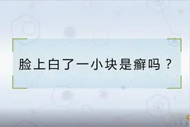 脸上白了一小块就是癣吗？视频封面
