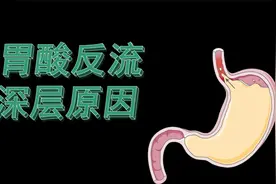 胃酸反流的深层原因之一视频封面