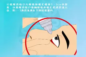 消炎止疼药还能用在眼睛上？没错！Mark双氯芬酸钠滴眼液！视频封面