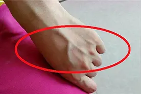 为啥有人手上的青筋会凸起？青筋多说明身体差？专家告诉你答案视频封面