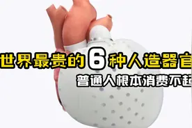 世界上最贵的6种人造器官，看看你能消费得起几种？