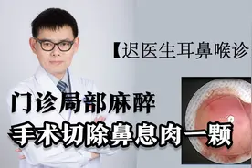 【迟医生耳鼻喉诊室】门诊局部麻醉切除鼻息肉，荔枝肉样的一坨视频封面