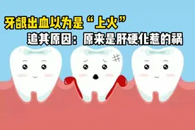 牙龈出血以为是“上火”，追其原因：原来是肝硬化惹的祸视频封面