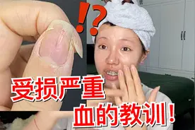 差点“拔指甲”？美甲的这些危害千万要小心了！视频封面