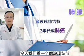 磨玻璃肺结节，3个表现提示肺癌风险大，医生讲CT视频封面