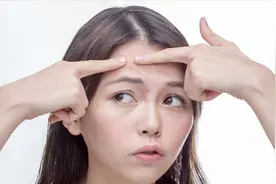 痤疮疤痕能自己长好吗？小妙招：这样敷面膜祛痘印效果或更佳视频封面