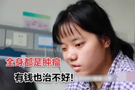 女孩左右眼不对称，医生查出罕见疾病，全身布满肿瘤，根本没法治视频封面